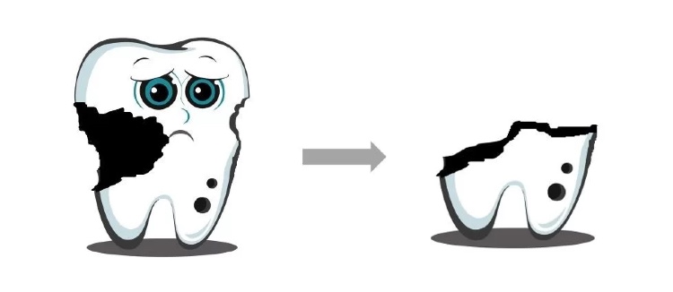 良心牙医不建议拔智齿残根,牙齿残根怎么处理视频