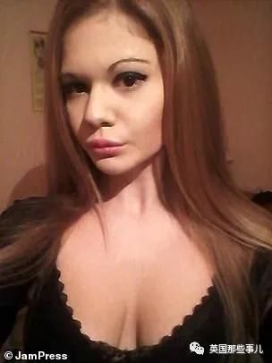 20次整容成功的女人,20次丰唇