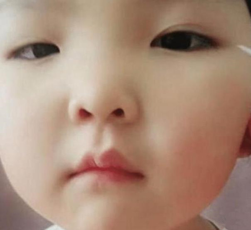 妈妈强行给1岁女儿割双眼皮,妈妈给割双眼皮