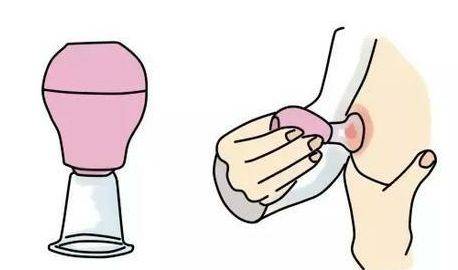 孕妇在怀孕中乳房有变化吗,怀孕后乳房不可避免的3个变化