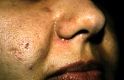 靠护肤品真能缩小毛孔吗,护肤品是怎么让毛孔缩小的