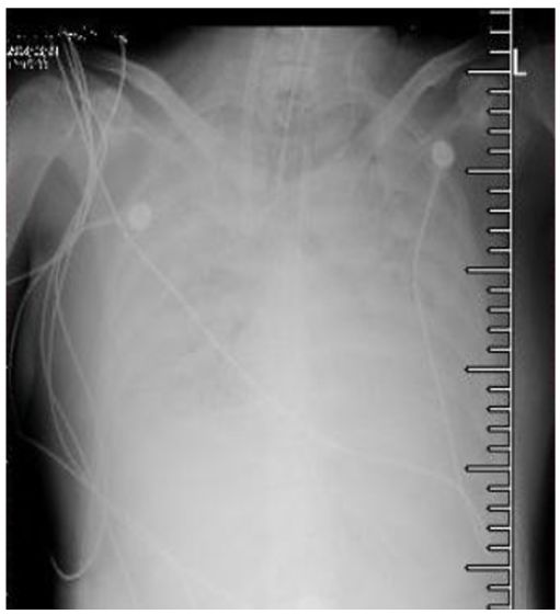 陈荣昌在哪个医院,陈荣昌广州呼吸疾病研究所所长