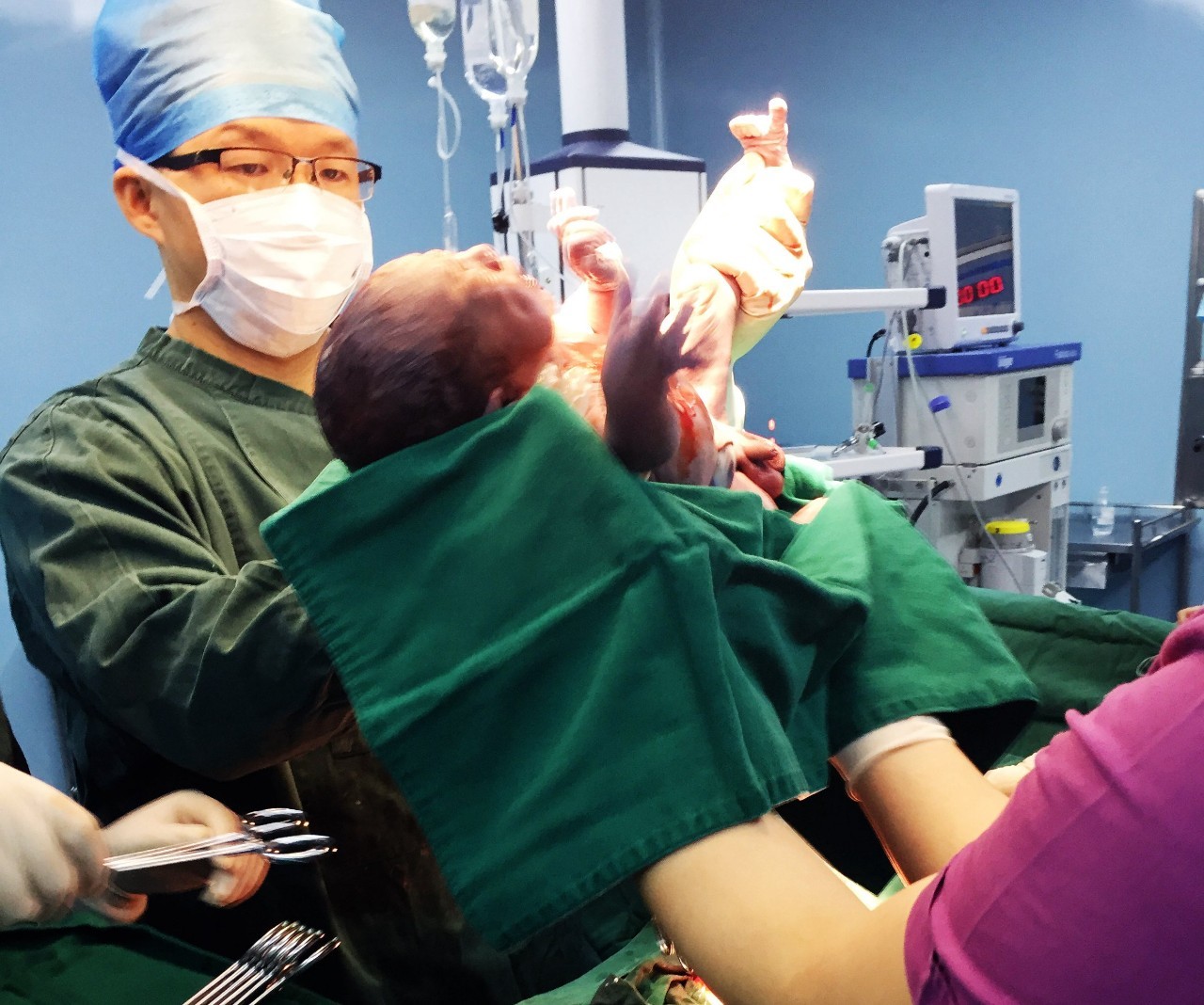 剖腹产手术最重要的步骤,剖腹产要做什么流程