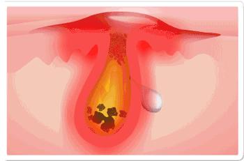 泫雅宣传品牌内衣，身材有致性感迷人，皮肤光滑透亮惹人爱