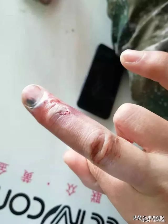 如果疫情再下去你能熬多久 (疫情我们能熬过去吗)