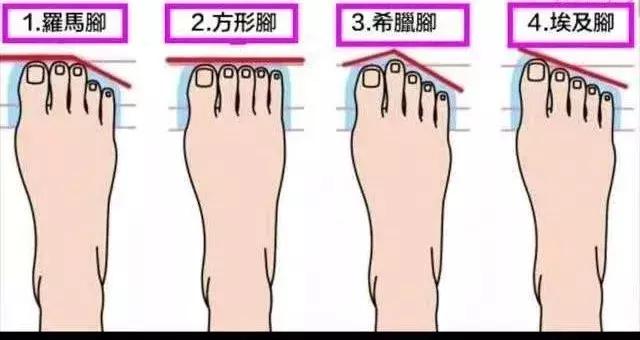 埃及脚希腊脚罗马脚区别,罗马脚希腊脚埃及脚