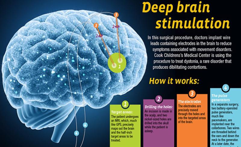 SpaceX不申请专利？起底马斯克商业帝国下的“专利军团”