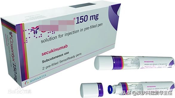 乙肝银屑病如何用生物制剂,有银屑病治疗乙肝能用干扰素吗