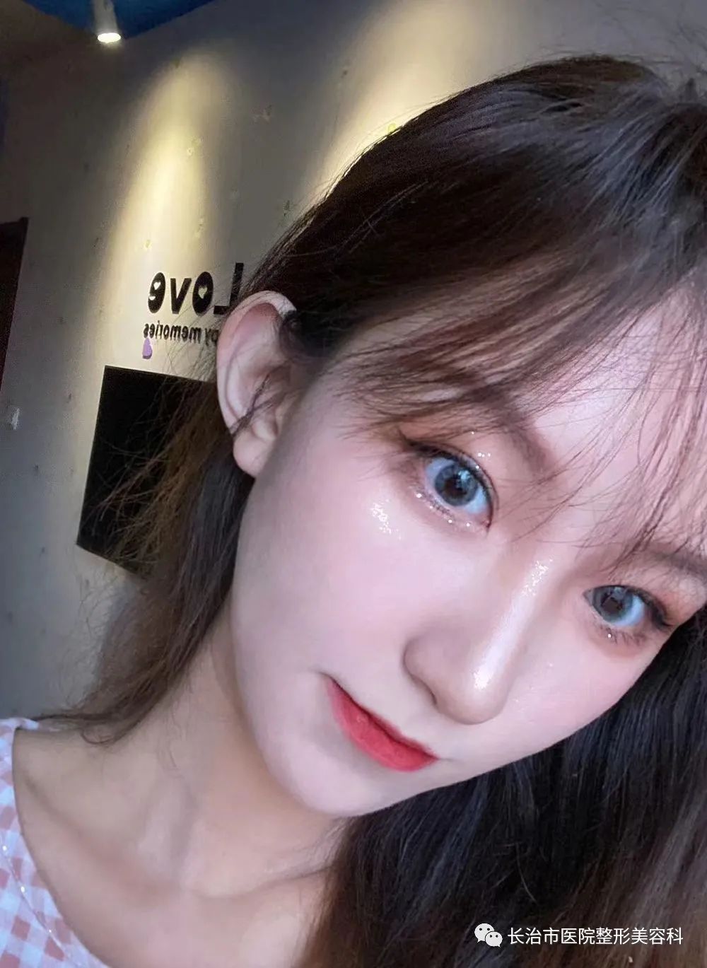 揭秘整形双眼皮内幕,割双眼皮术的价格