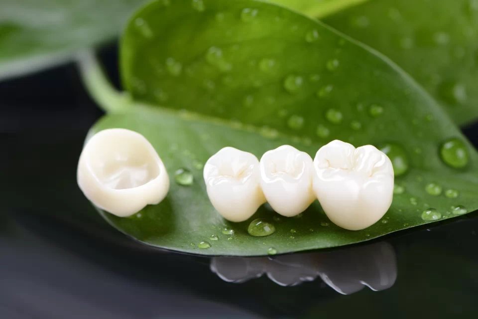 烤瓷牙的危害视频,烤瓷牙换全瓷牙烤瓷牙要不要取掉