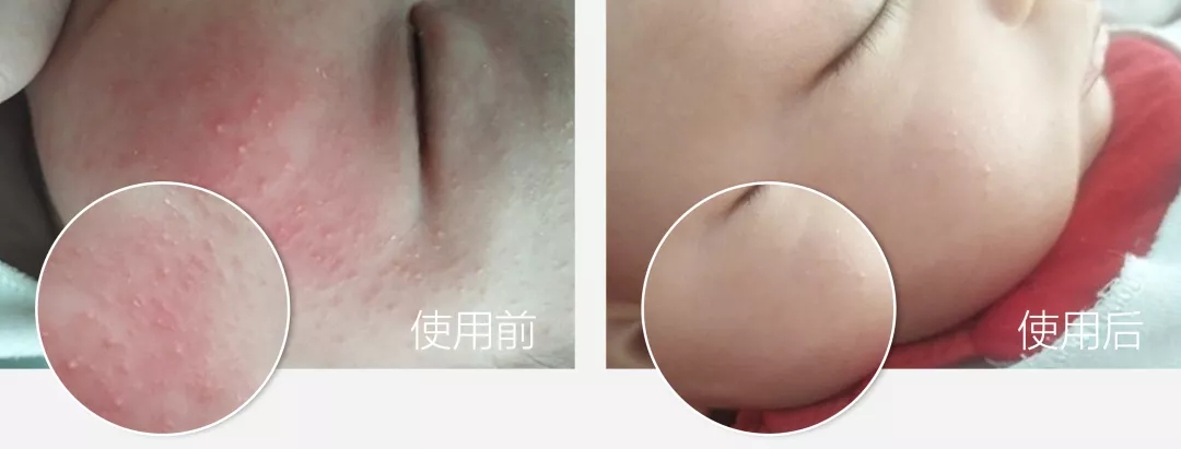 日本蜂王乳面霜,日本的霜好用不过敏干性皮肤用