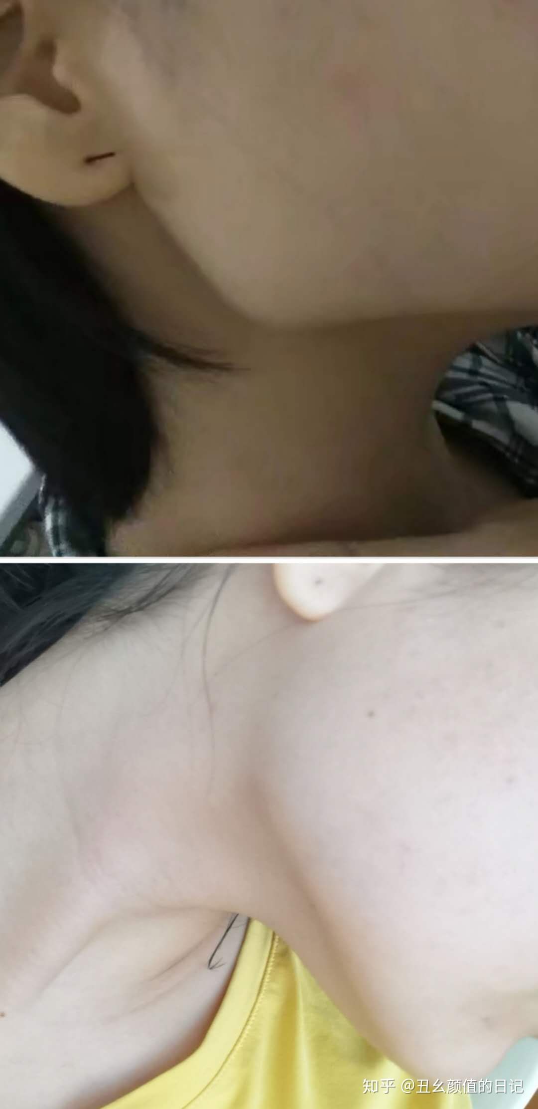 针对三种大饼脸的瘦脸按摩方法,怎么瘦脸解决大小脸