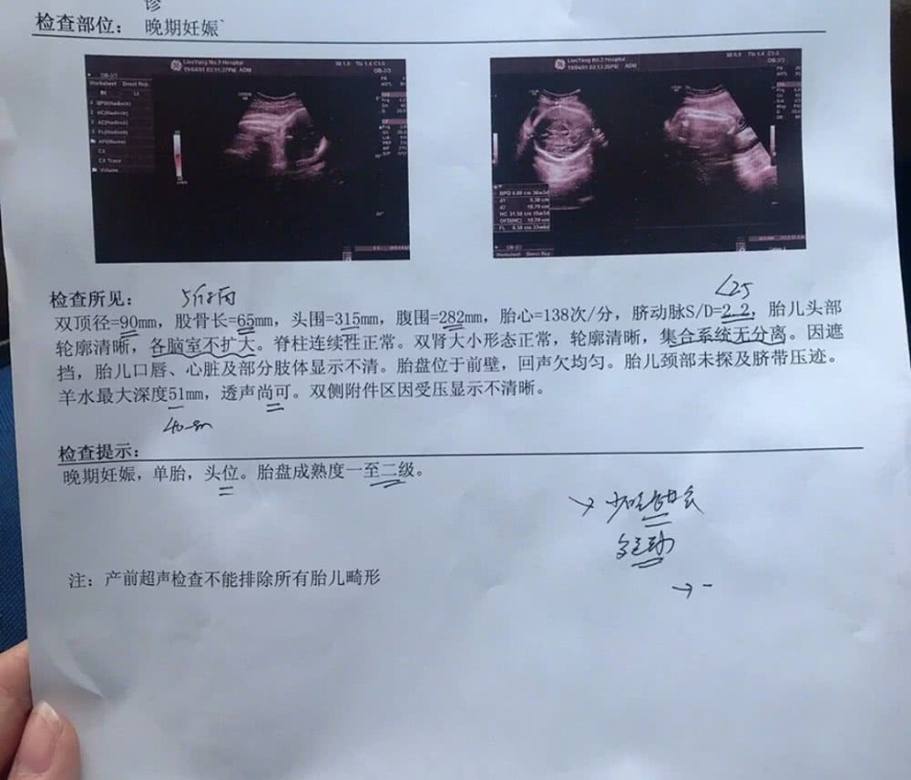 孕期做什么检查才能排除基因问题,孕期要做什么检查能确诊胎停