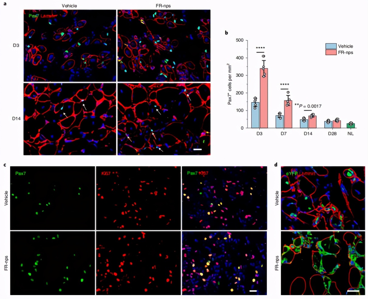 攻克单能干细胞疗法难题!科学家实现肌肉干细胞体内外高效扩增
