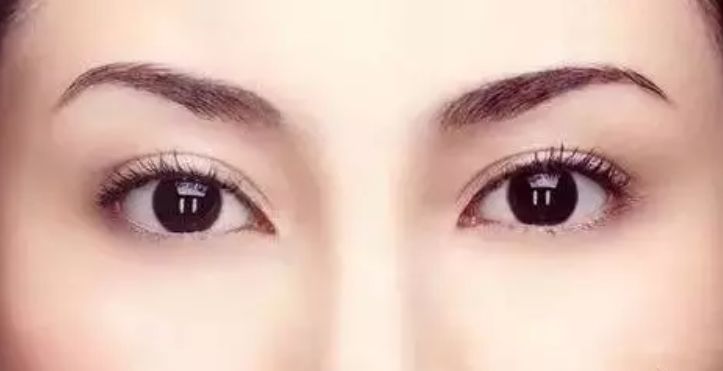 宝宝双眼不一样大,宝宝眼睛大小不一样什么原因