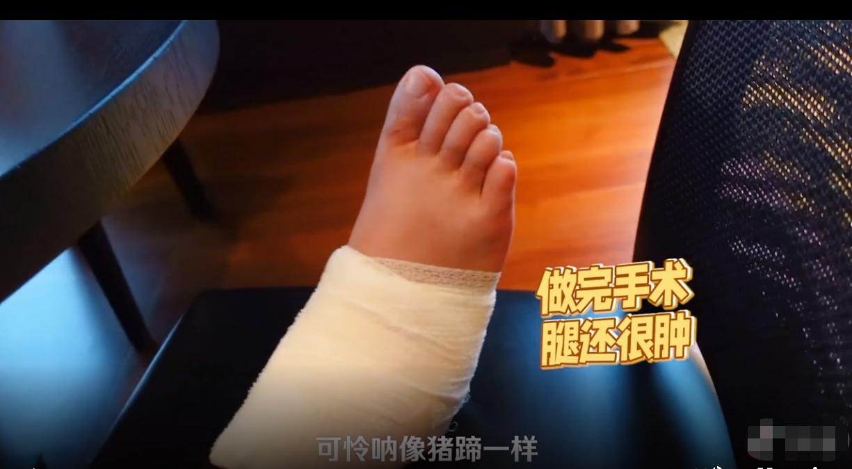 陈赫手术后出院依然逗笑众人,陈赫张子萱产后出院