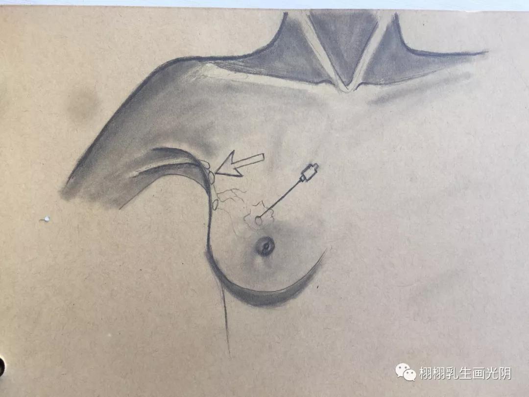 经期淋巴结肿大怎么回事,腹部淋巴结肿大怎么回事