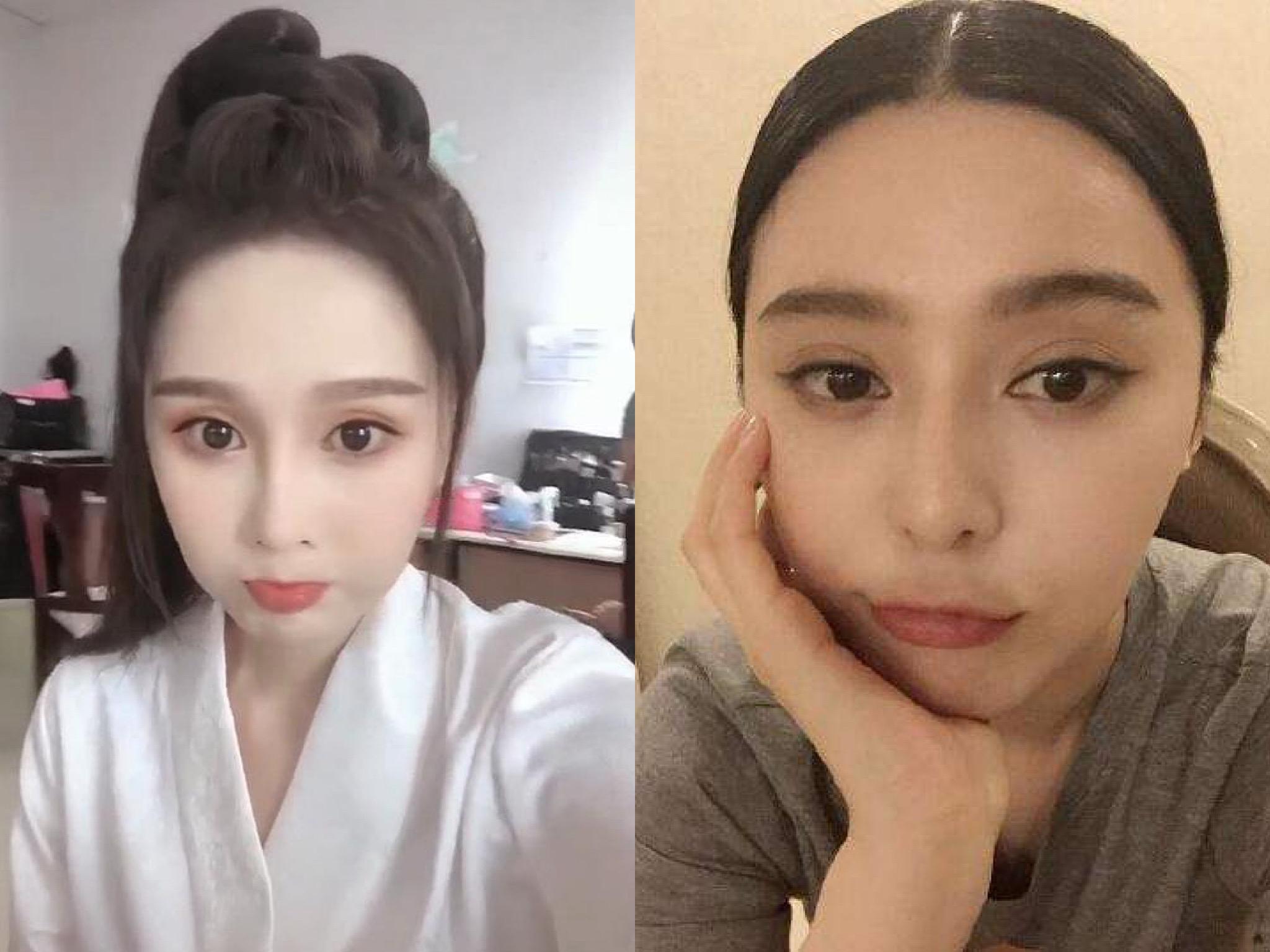 赵本山女儿整容被质疑,赵本山女儿花30万整容遭亲妈痛批