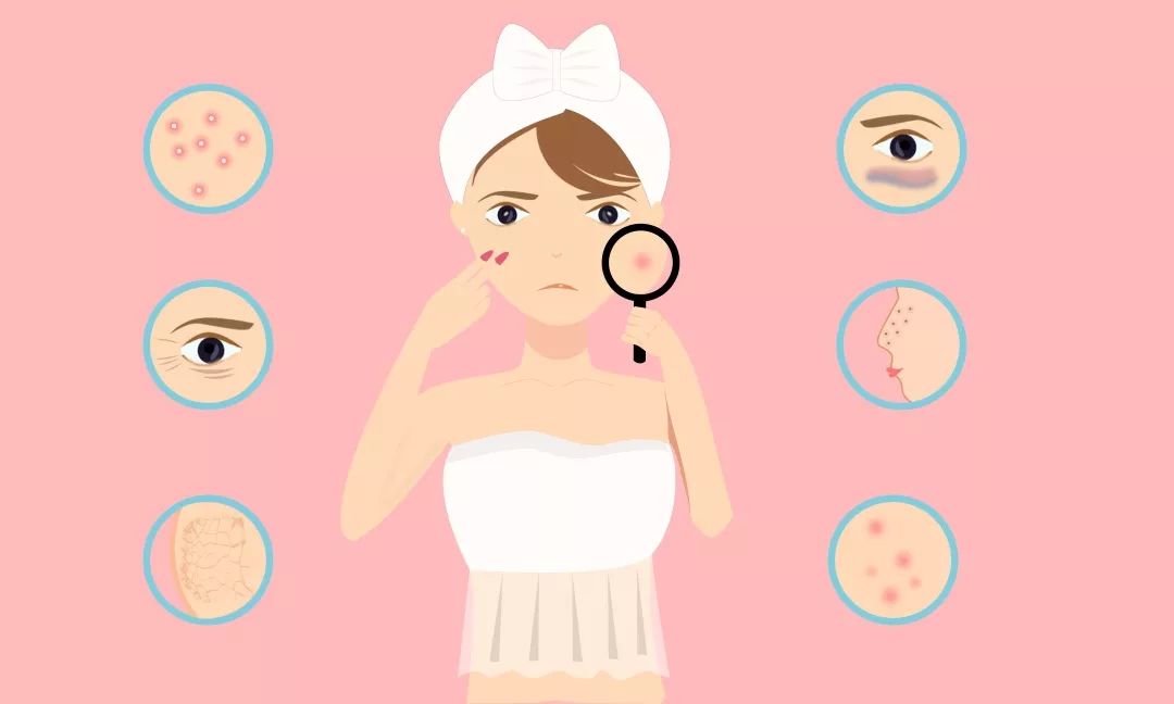 管不住自己的手老是挤痘痘,管不住手喜欢挤痘痘