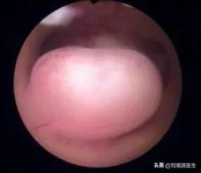 免疫不良妊娠可以通过中药治疗吗,免疫相关不良妊娠答疑解惑