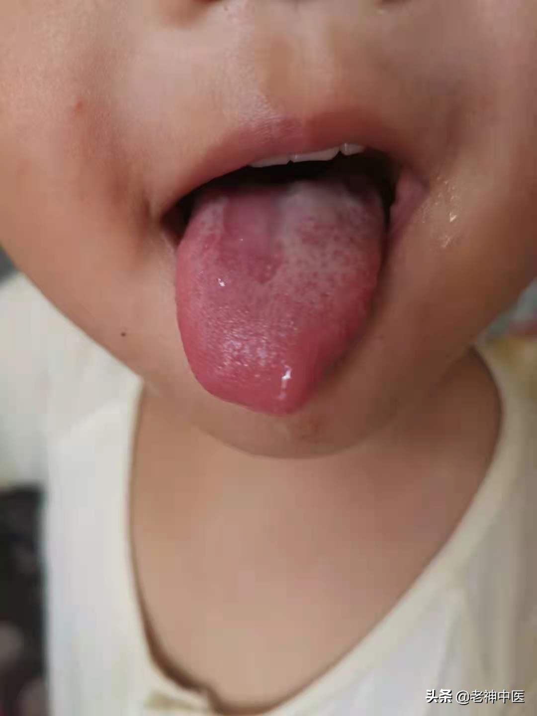 孩子不吃饭地图舌睡觉不踏实,宝宝不吃饭舌苔发黑怎么办