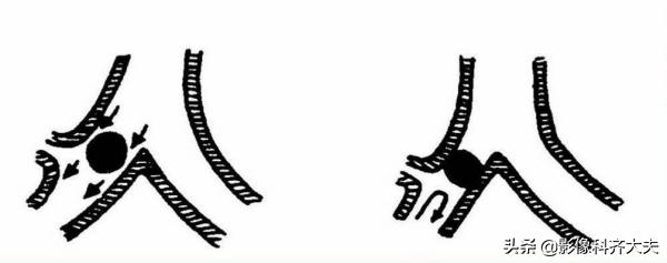 小儿气管镜怎么检查,小儿ct检查全过程视频