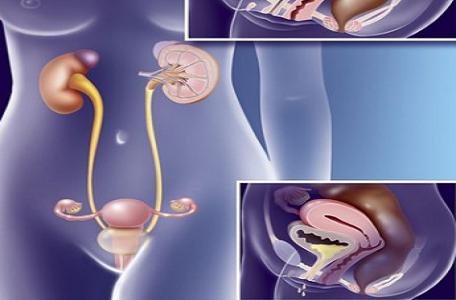 女性尿失禁注意哪些事项,对待女人的6个禁忌