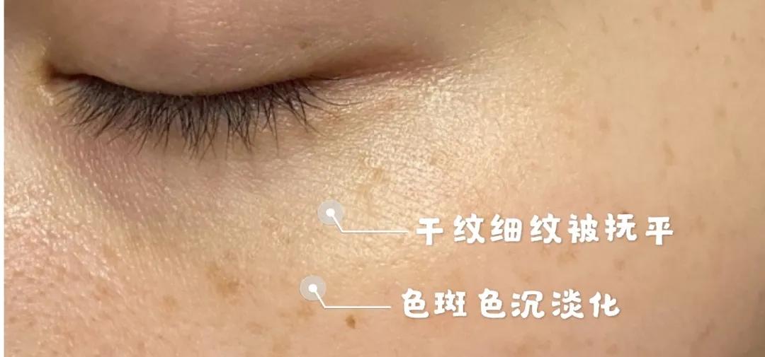 小玛急救水修护霜,小玛急救水值得入手吗