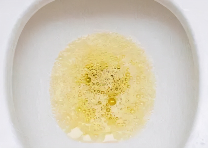 有蛋白尿就一定是肾病吗,出现蛋白尿是不是说明肾脏有损伤