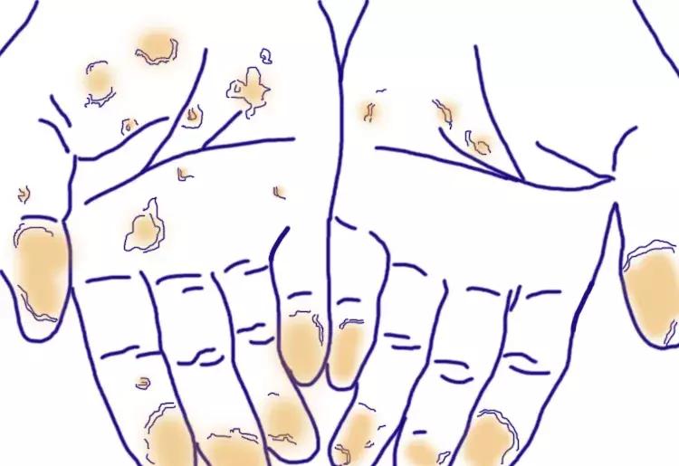 又到了一年手脱皮的季节了,又到了手干手裂的季节