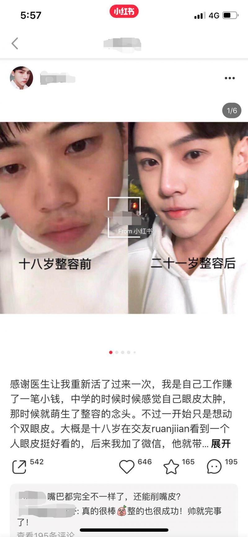 杭州小伙整容,整容被医院侵权的杭州小哥