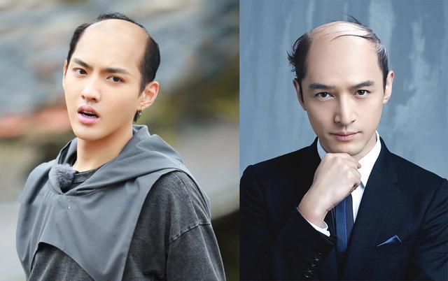 小刺猬因压力大秃顶，你老公的发际线是不是也开始后移了？