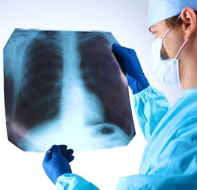 肺结节明确是肺癌要不要立马手术,肺结节离肺癌有多远你必须要知道