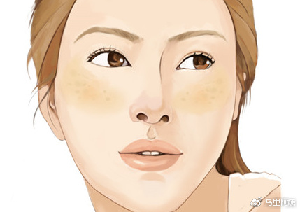 雀斑、*褐斑黄**、咖啡斑、晒斑、妊娠斑...分不清还谈什么祛斑