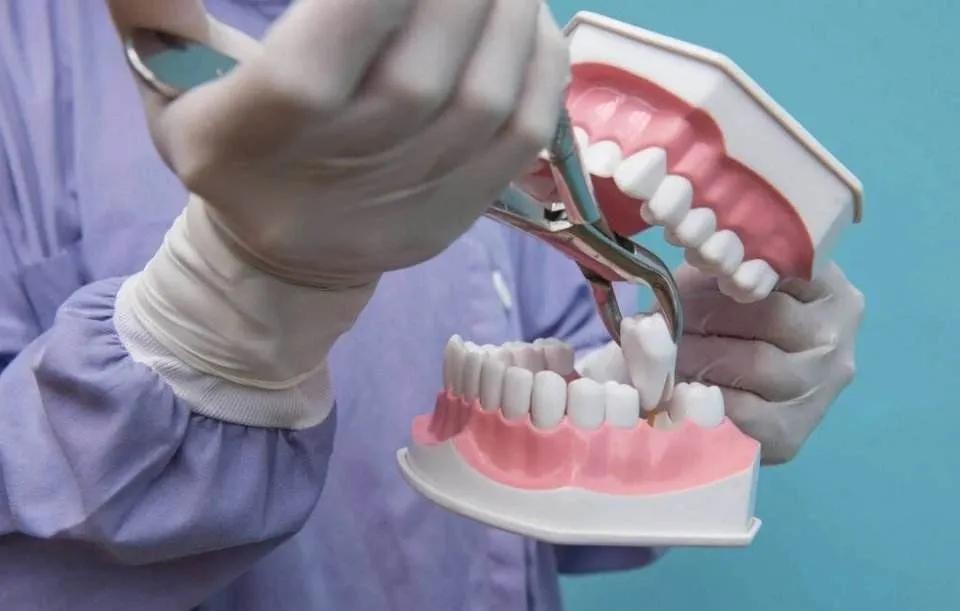 拔牙10天了还会得干槽症吗,拔牙之后干槽症疼痛会持续多久