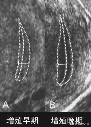 中医治疗子宫内膜薄,子宫内膜薄什么意思