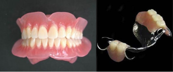 假牙引起口炎怎么处理,假牙引起的口腔炎症怎么治