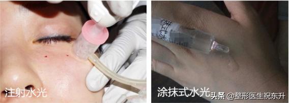 水光涂抹的和针剂的区别,涂抹式水光和注射水光哪个更好