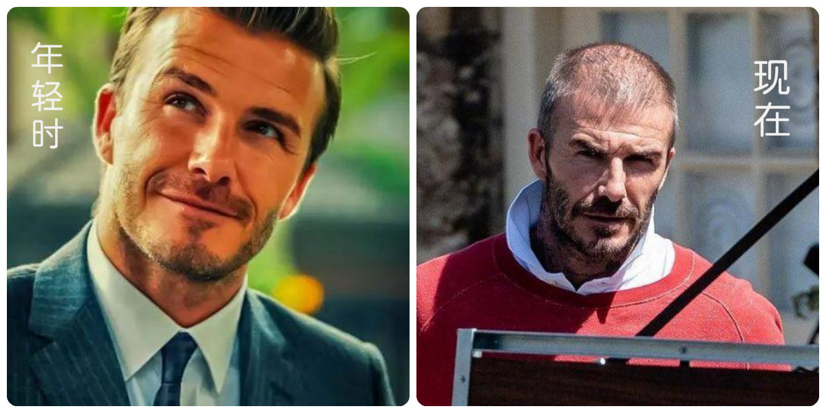 贝克汉姆脱发,贝克汉姆被曝脱发角度问题