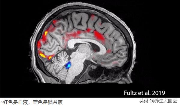 睡眠时也会被“*脑洗**”！教你4招睡好觉，清除大脑垃圾，预防痴呆!