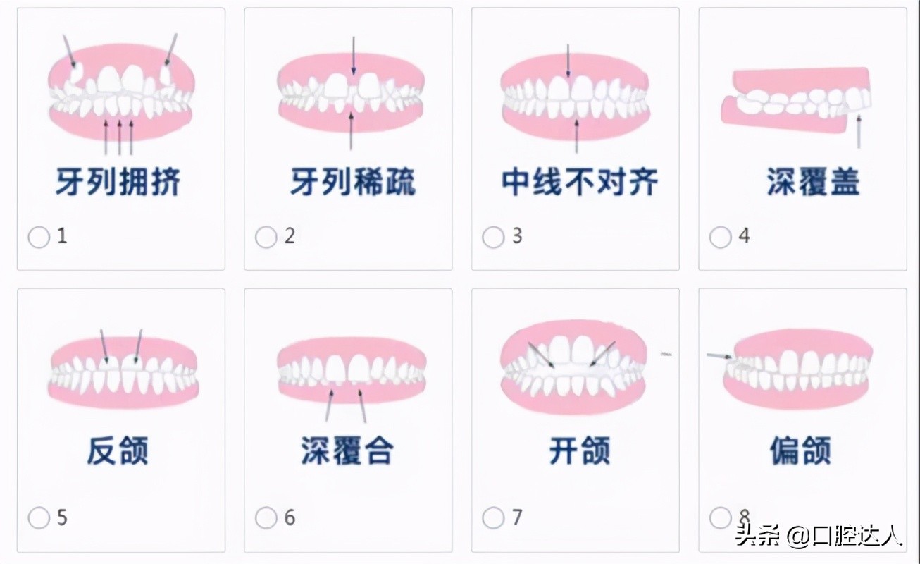 牙齿矫正可以只做单排吗,单排牙齿矫正一般要多少钱