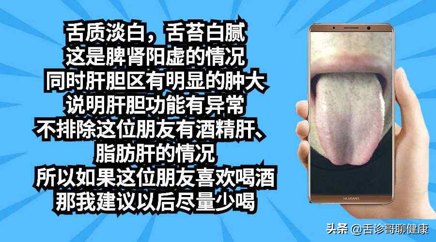 最实用舌诊图解专家总结六大舌象,零基础学舌诊气郁体质典型舌象