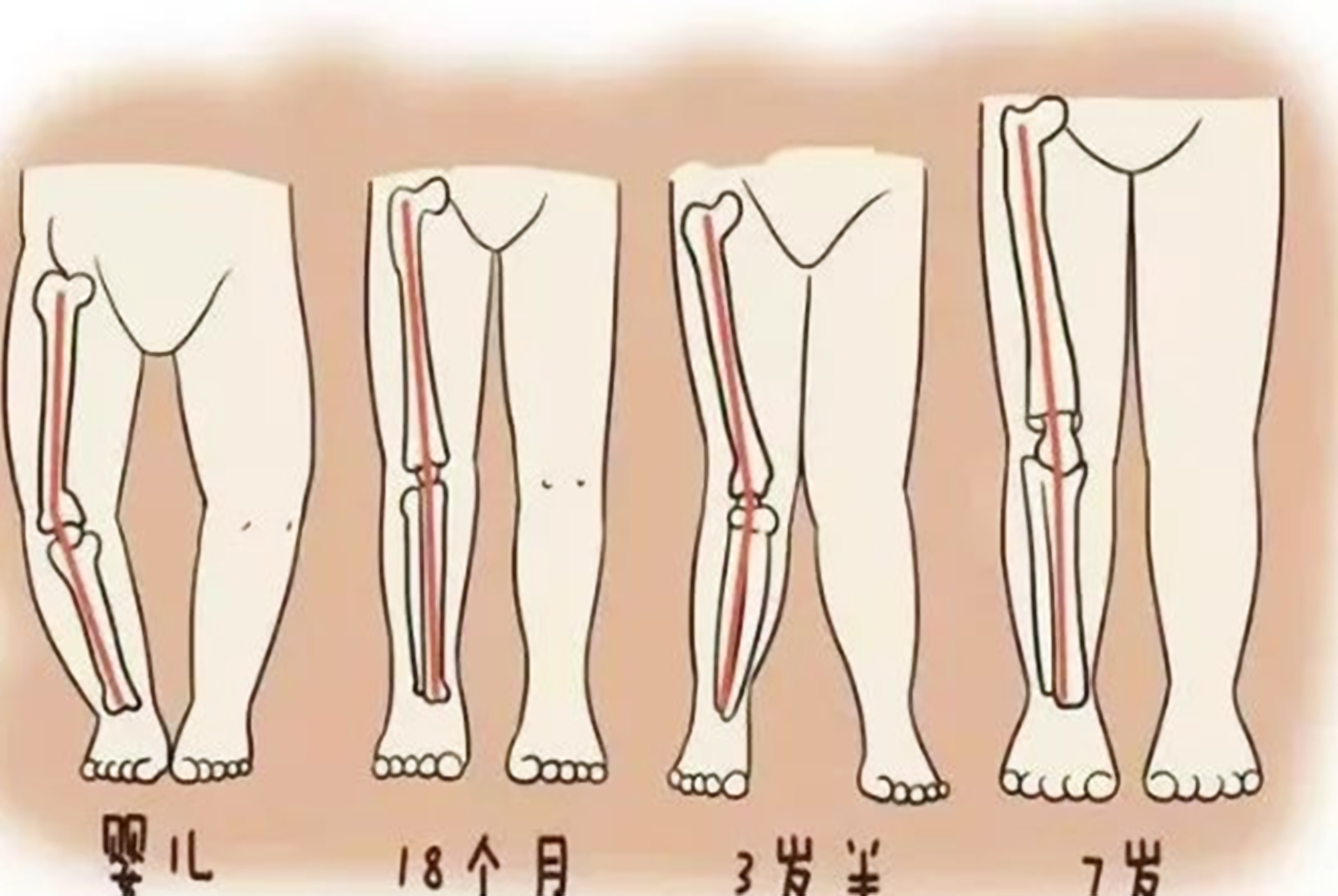 为什么中国孩子容易“罗圈腿”?多半是和父母的这3种习惯有关