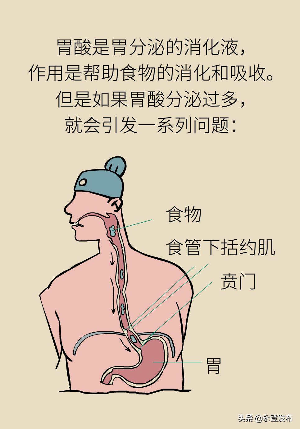 胃酸过多反酸烧心如何缓解,胃酸过多反胃烧心怎么办