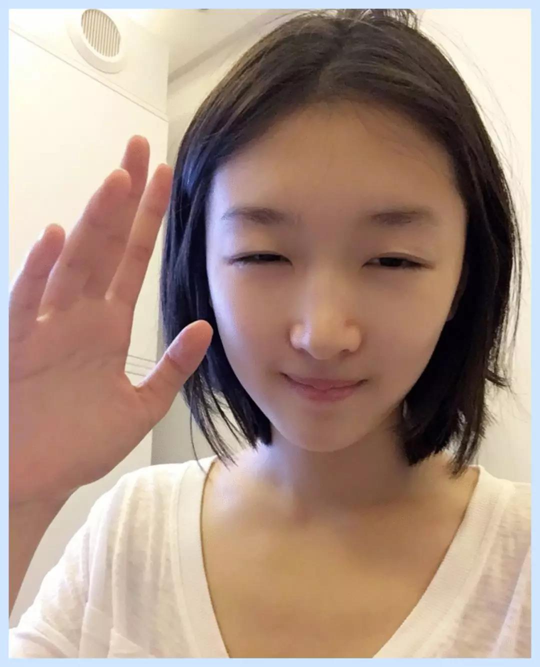 5个靠谱祛痘印的方法,祛痘印最快的方法淡化痘印