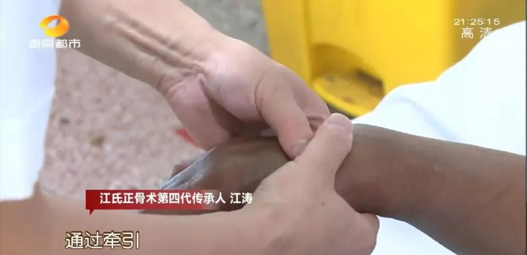 断骨手法复位视频,身怀绝技全集