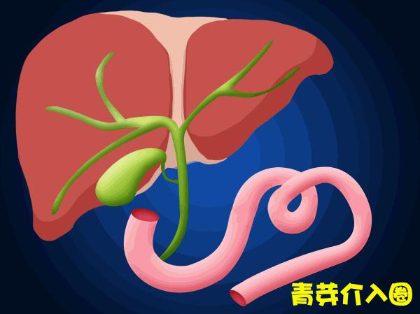 胆道阻塞眼睛发黄图片,胆管堵塞全身发黄中医治疗