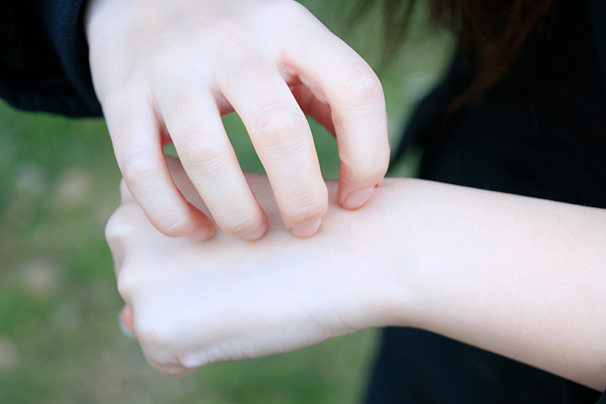 皮肤过敏吃什么最好能缓解,过敏1级可以吃过敏食物吗