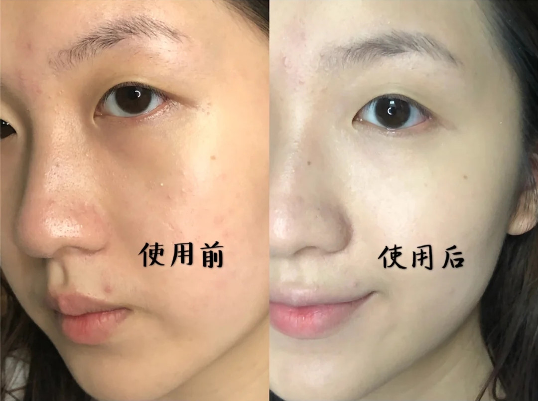 隔离要全脸涂吗,隔离能不能直接用手涂