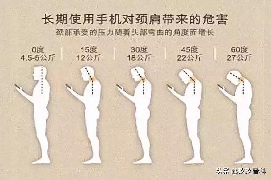 颈椎死穴,颈椎上的死穴在哪里